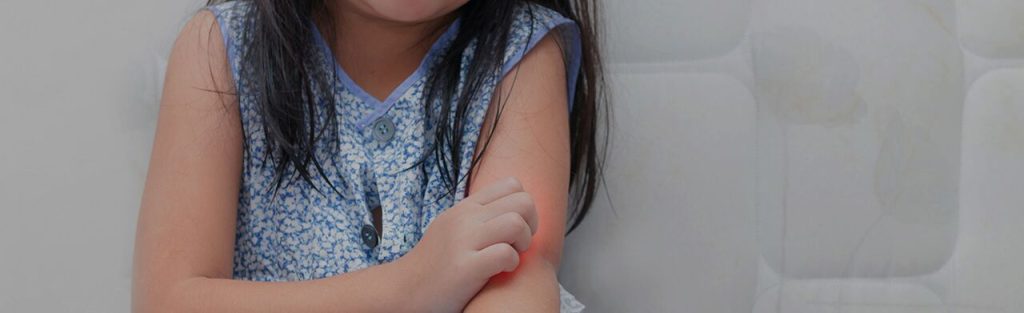 Alergias alimentares em crianças