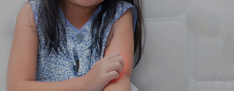 Alergias alimentares em crianças