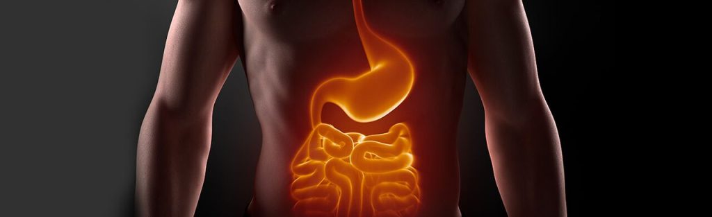 Diverticulite e diverticulose