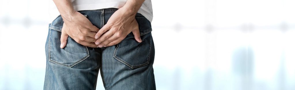 Cisto pilonidal: o que é, como acontece e como tratar