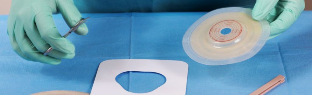 Ostomias no Câncer Colorretal: tire suas dúvidas