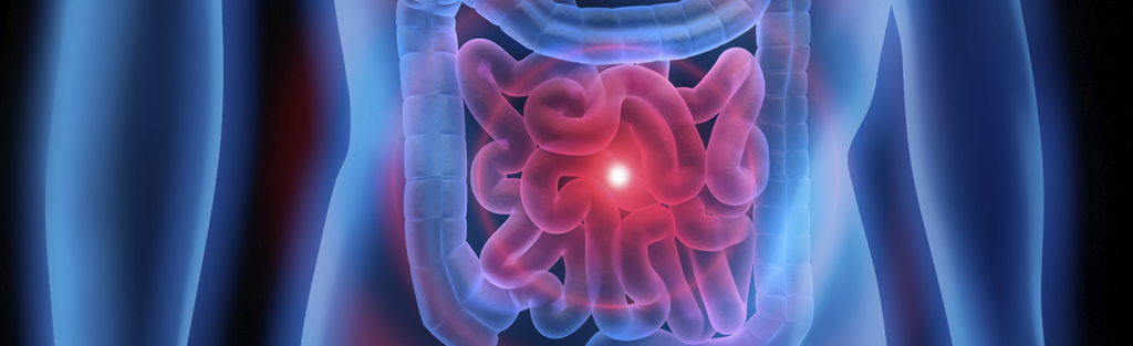 O que são os Pólipos Intestinais? Acompanhe