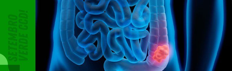 Dados relevantes sobre o câncer de intestino. Acompanhe